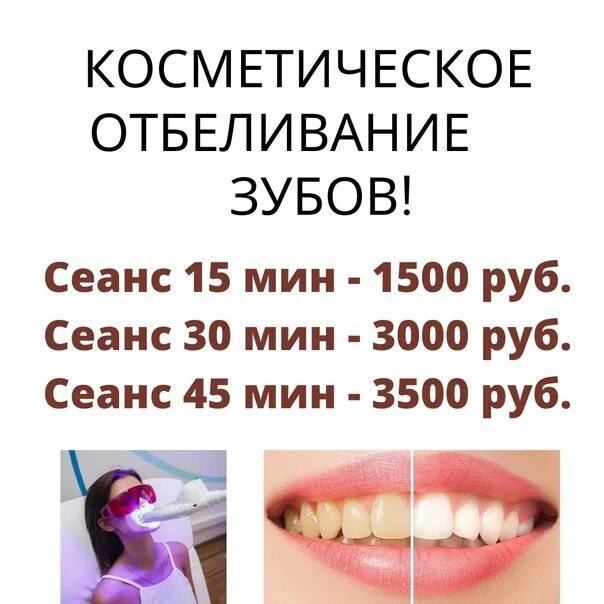 Сколько можно отбелить зубы. Сколько можно отбелить зубы