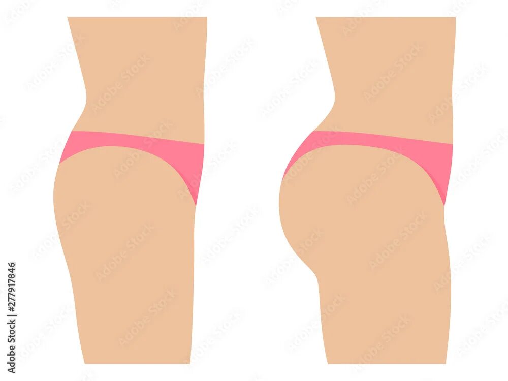 Butts tg