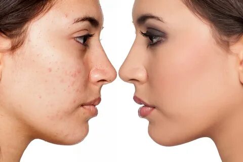 Face comparison