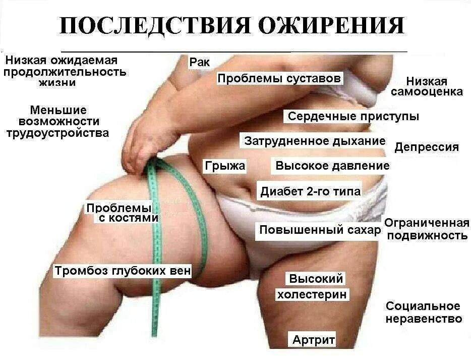 Осложнения при ожирении.