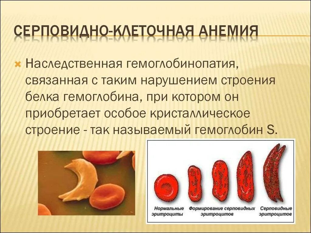 При каком заболевании эритроцитов