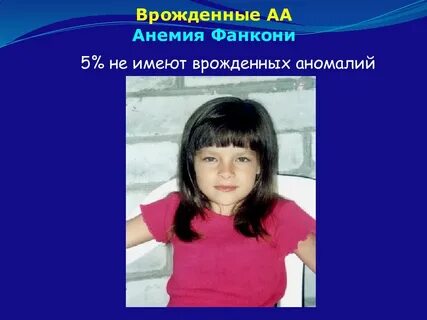 Анемия фанкони