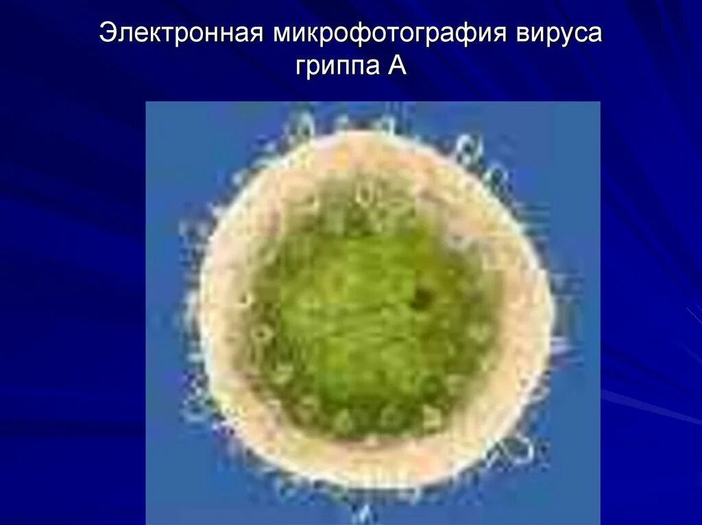 Вирус парагриппа микрофотография. Электронная микрофотография вируса гриппа а. Вирус гриппа микрофотография. Вирус парагриппа под микроскопом.