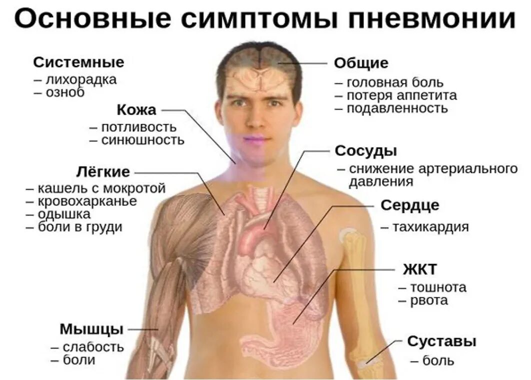 Как отличить болит. Основные симптомы при пневмонии. Воспаление лёгких симптомы. Восполении лёгких, симптомы.