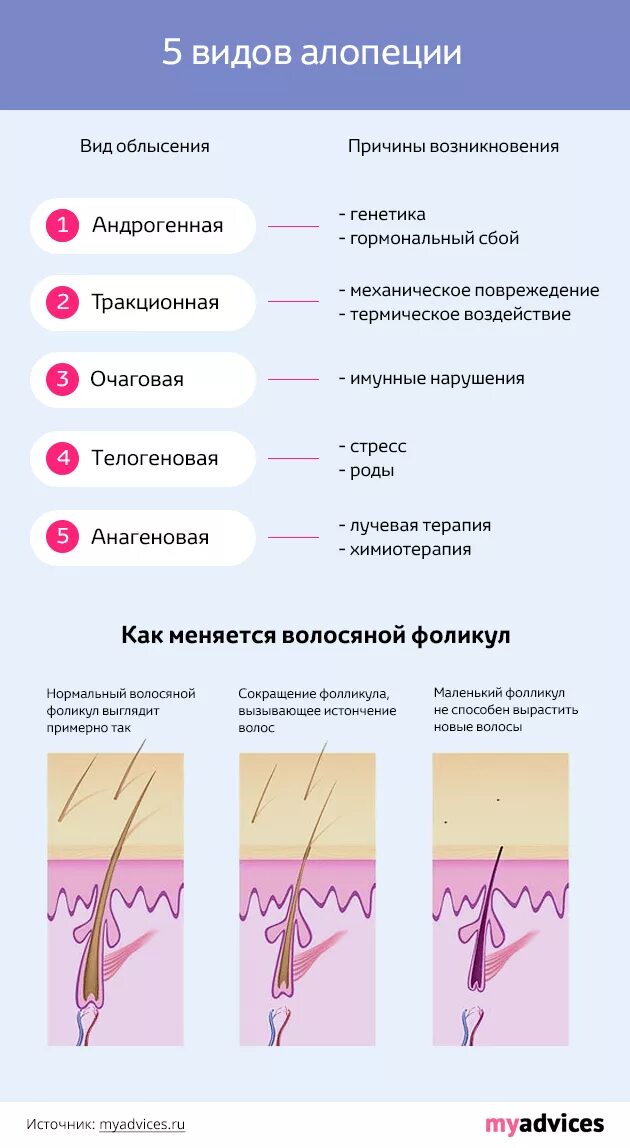 Выпадение волос причины схема. Выпадение волос факторы. Выпадение волос алопеция. Назовите причины преждевременного выпадения волос. Выпадают волосы гормональное