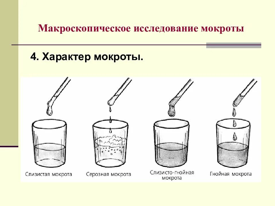 Кашель с выделением гнойной мокроты. Исследование мокроты для лабораторных исследований. Макроскопическое исследование мокроты. Исследование мокроты у детей. Исследование мокроты рисунки.