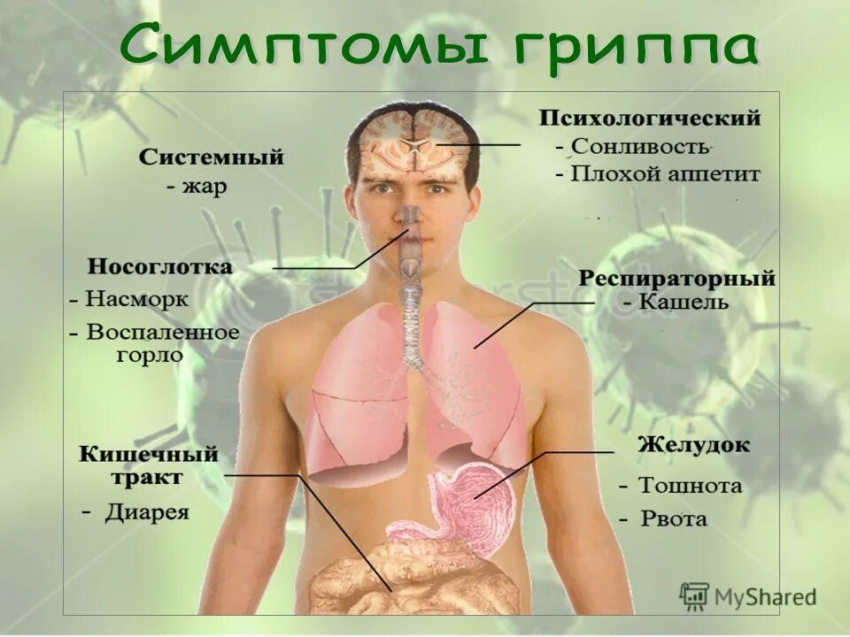 Симптомы гриппа. Свиной грипп. Симптомы гриппа презентация. Свиной грипп презентация.