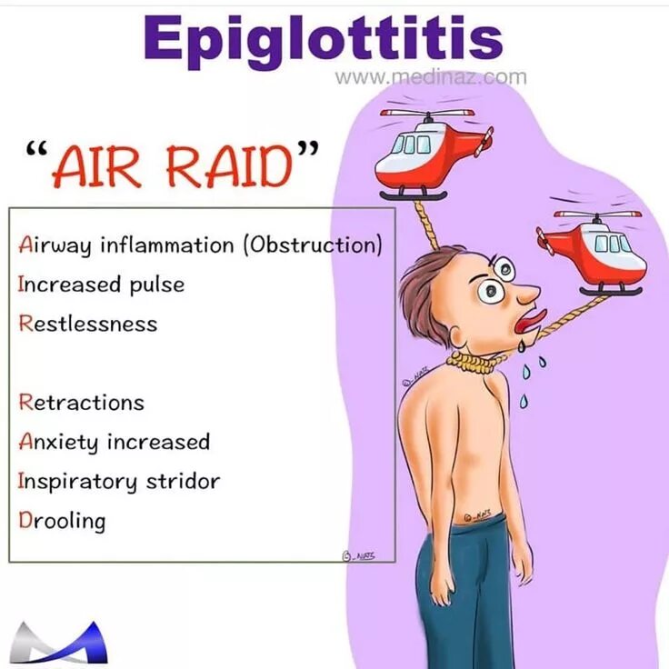 Эпиглоттит симптомы. Эпиглоттит профилактика. Этиология острый эпиглоттит.