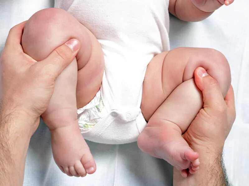 Врожденный вывих бедра (дисплазия бедра). Подвывих тазобедренного сустава у детей симптомы. Упражнения при дисплазии тазобедренных суставов у грудничка. Ограниченное отведение бедер у грудничка. Ограничение отведения бедра у младенца.