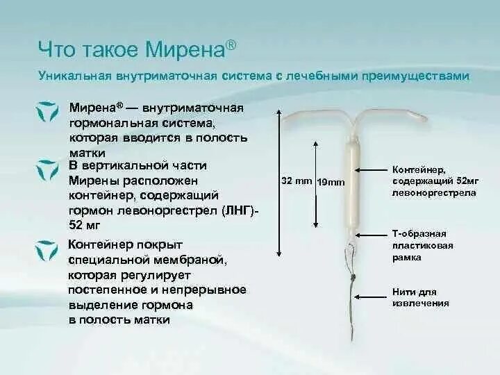 Внутриматочная гормональная система Мирена. Внутриматочная гормональная спираль Мирена. ЛНГ-ВМС Мирена. Mirena спираль противозачаточная. Ставит отзывы врачей