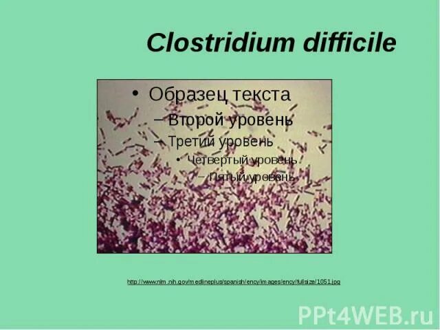 Clostridium difficile что это. Клостридии диффициле морфология. Морфология клостридиум диффициле. Клостридии диффициле классификация. Clostridium difficile презентация.