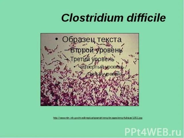 Клостридии диффициле морфология. Морфология клостридиум диффициле. Клостридии диффициле классификация. Clostridium difficile презентация. Clostridium difficile что это