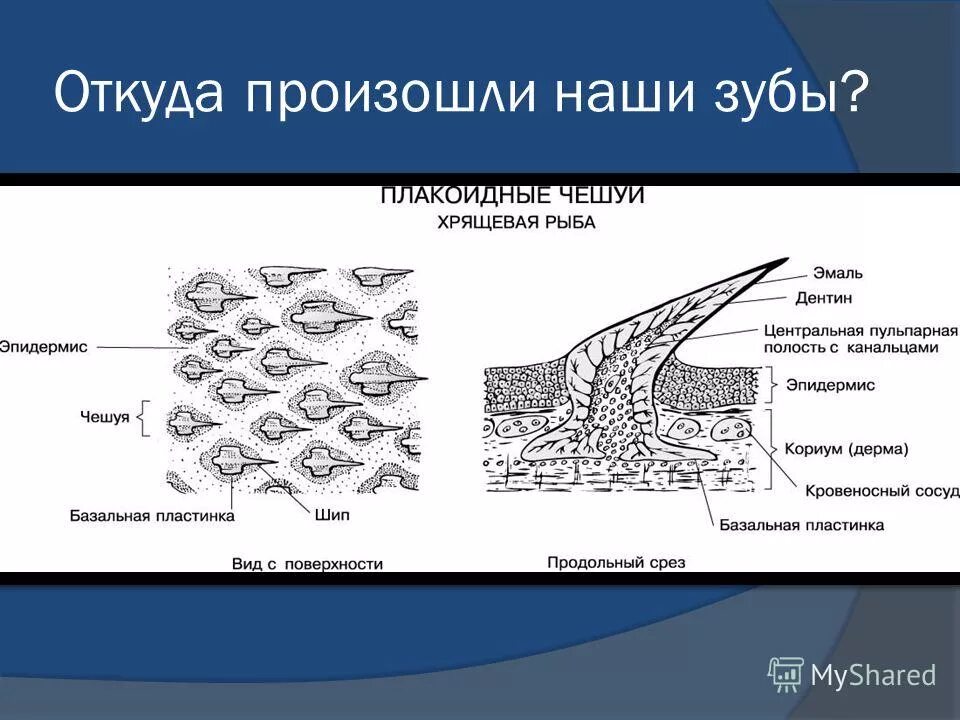 схема строения роговой чешуйки. зубы акулы являются видоизмененными плакоидными чешуями. кожа покрыта примитивными плакоидными пластинками. кожа покрыта примитивными плакоидными пластинками. плакоидная чешуя.