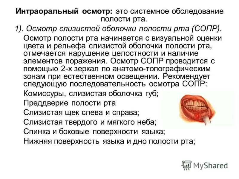 Методика осмотра ротовой полости. Интраоральный осмотр: это системное обследование полости рта. Алгоритм обследования стоматологического больного. Методика осмотра челюстно-лицевой области. Методика осмотра полости рта.