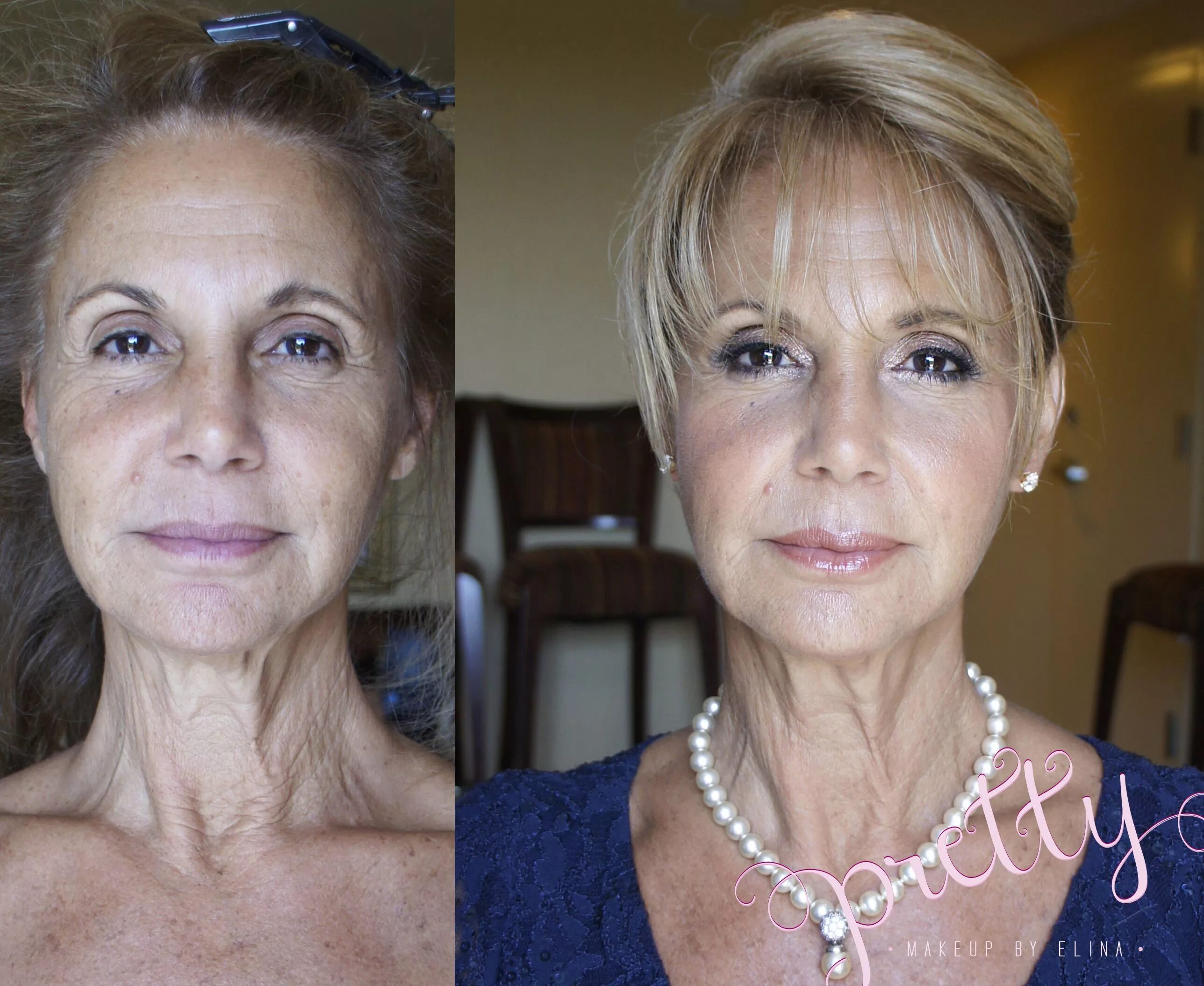 Granny before