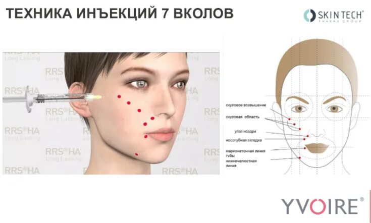 Как часто можно колоть лицо