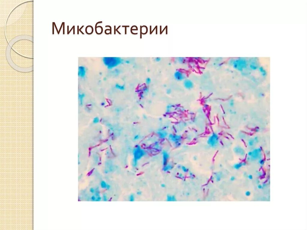 Mycobacterium tuberculosis complex
