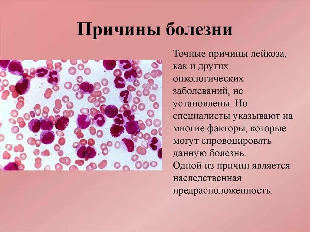 Какие признаки заболевание крови. Мегакариоцитарный лейкоз. Заболевание крови лейкоз. Лейкоз причины заболевания. Лейкемия причины заболевания.