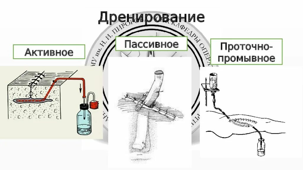 Промывание гнойной раны. Физическая антисептика дренирование. Дренирование проточно промывное дренирование. Проточно-промывное дренирование РАН. Проточно-аспирационное дренирование.