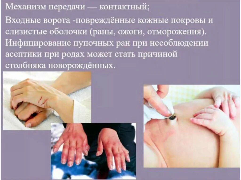 Первая помощь при царапинах и ссадинах. Нарушение целостности кожных покровов. Колотая рана и резаная рана. Нарушение целостности тканей при травмах. Оказания первой помощи при травмах кожи.
