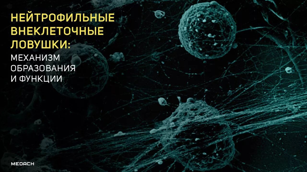 Кинетика нейтрофилов. Нетоз. Нетоз нейтрофилов это. Ловушки нейтрофилов. Рецепторы нейтрофилов.