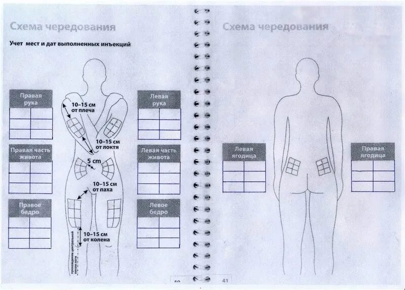 Схема места для уколов. Схема места Уколь. Схематические места инъекций. Место уколов в бедро