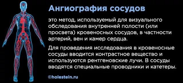 Как можно проверить сосуды