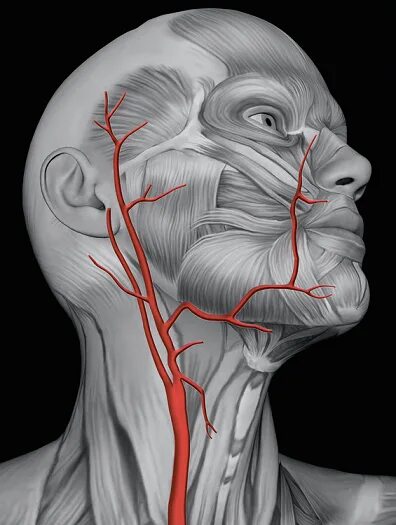 Наружная сонная артерия где. Паталогии внутренней сонной авртер.. Аневризма височной артерии.
