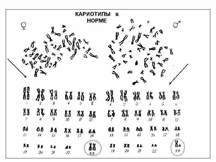 Кариотип человека определяют