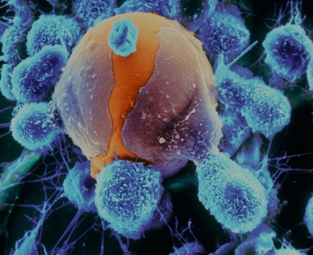 Клетки иммунной системы фагоциты. Фагоцит микрофотография. Фагоцитоз раковых клеток. Макрофаг поглощает бактерии. Макрофаги фагоцитоз