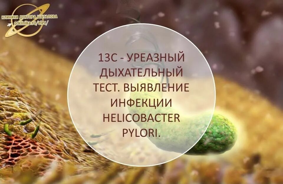 Подготовка к уреазному тесту. Дыхательный тест на хеликобактер. 13с-уреазный дыхательный тест на Helicobacter pylori. С13 дыхательный тест на хеликобактер. Дыхательный тест на хеликобактер пилори Ситилаб.