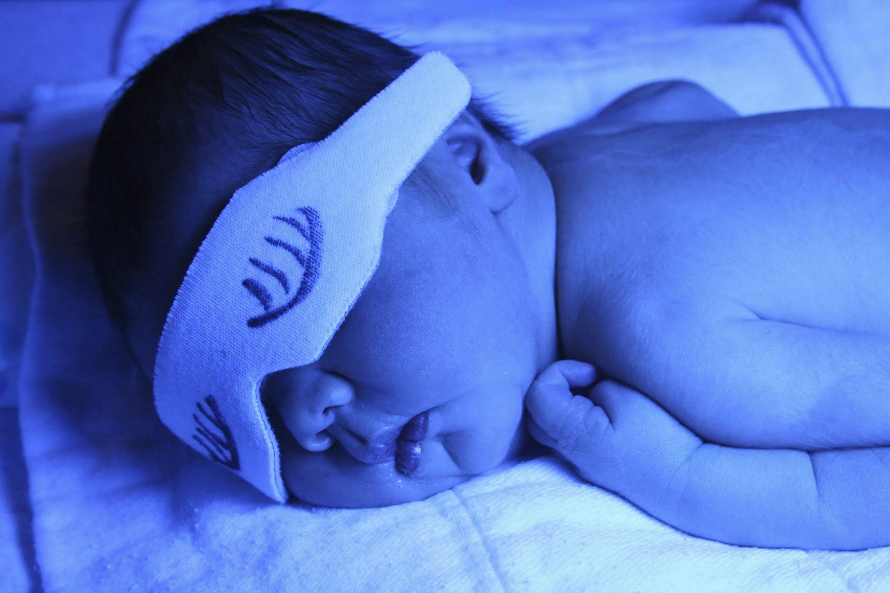 Пук новорожденных. Желтушка у новорожденных фототерапия. Лампа для желтушка у новорожденных. Очки для фототерапии новорожденных. Лампа для фототерапии.