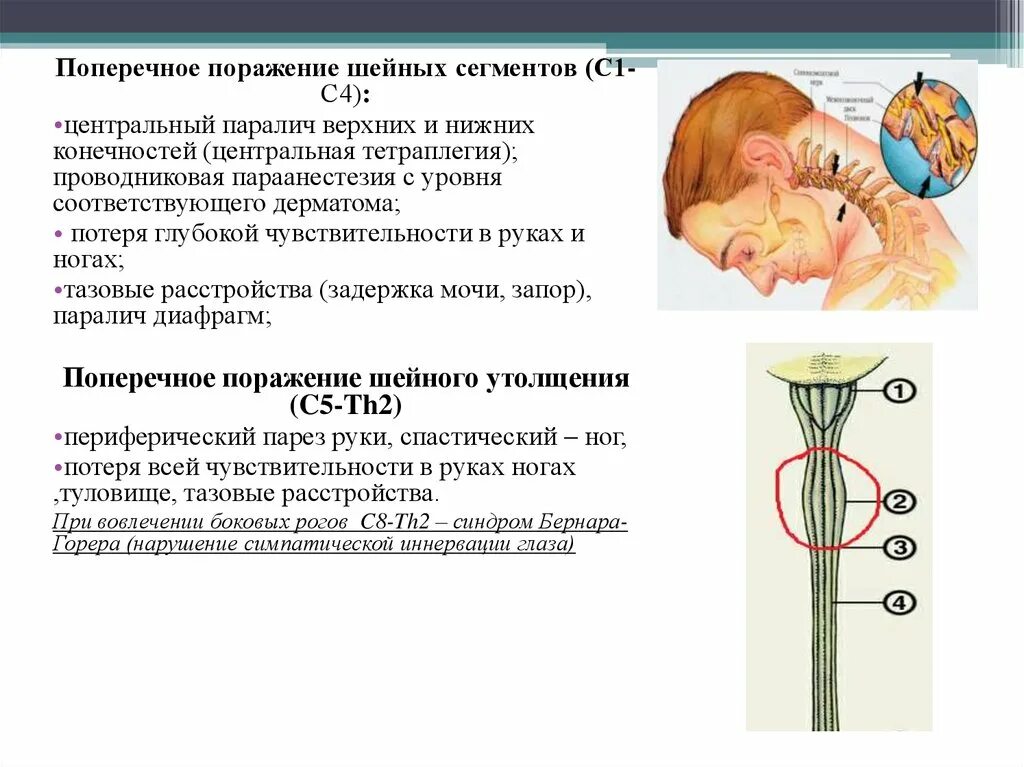 Шейный паралич. Тазовые нарушения по центральному и периферическому типу. Клиническая картина кривошеи. Шейный паралич. Шейный паралич.