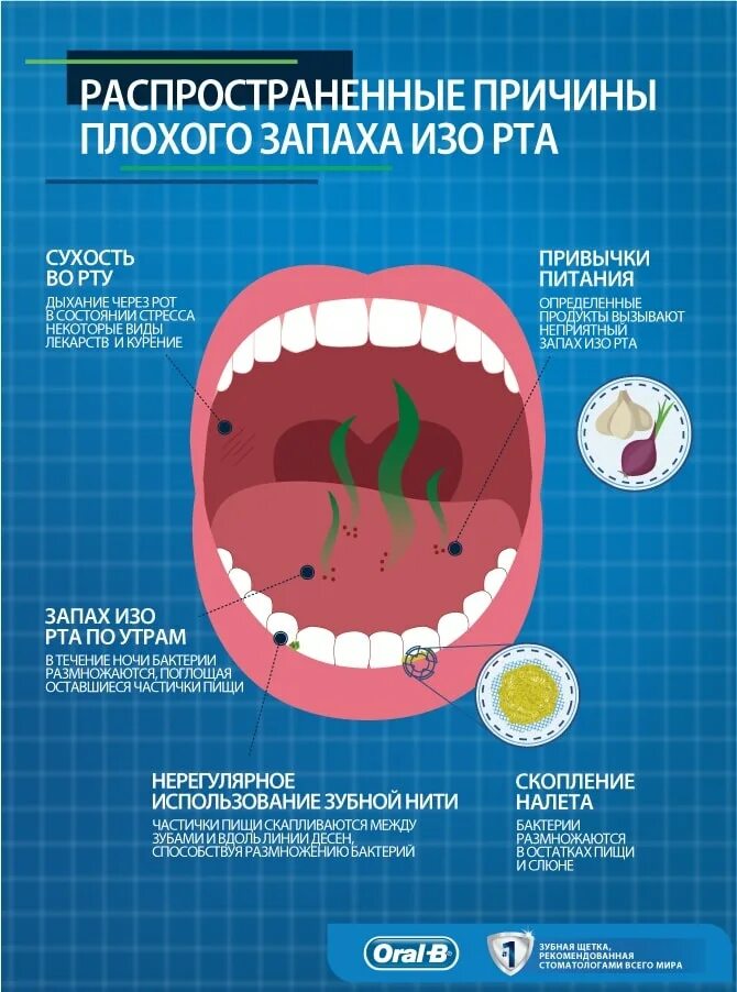 Почему рот воняет что делать. Неприятный запах изо рта. Запах изза РТВ причинф.