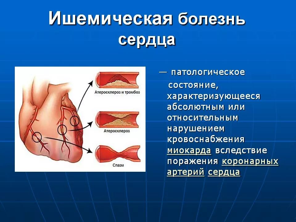 Ишемия симптомы у мужчин. Ишемическая болезнь сердца. Семемической болезни сердца. Ишемическое заболевание сердца.