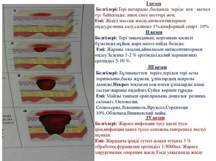 Менің кеудемдегі қызыл нүктелер