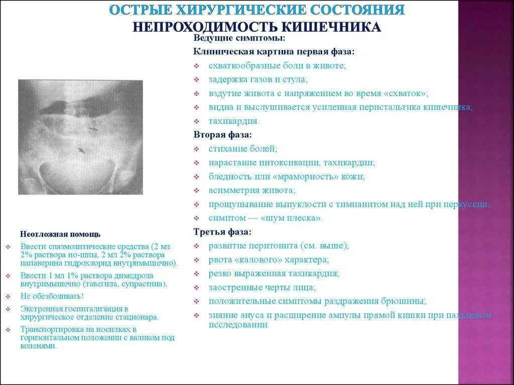 Симптомы непроходимости кишечника у взрослых. Симптомы кишечной непроходимости хирургия. хирургические симптомы инвагинации кишечника. симптомы при кишечной непроходимости. острая кишечная непроходимость симптомы.