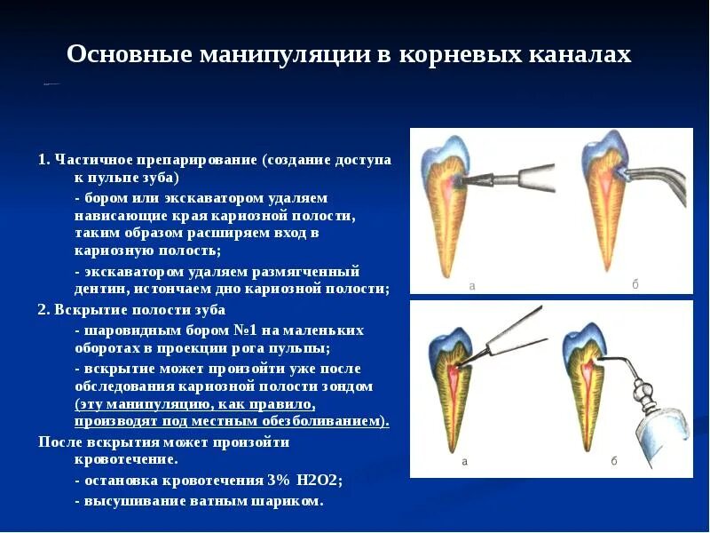 Корни и каналы зубов. Корни и корневые каналы зубов. Корневые каналы передних зубов. Формирование доступа к полости зуба. Количество каналов 6