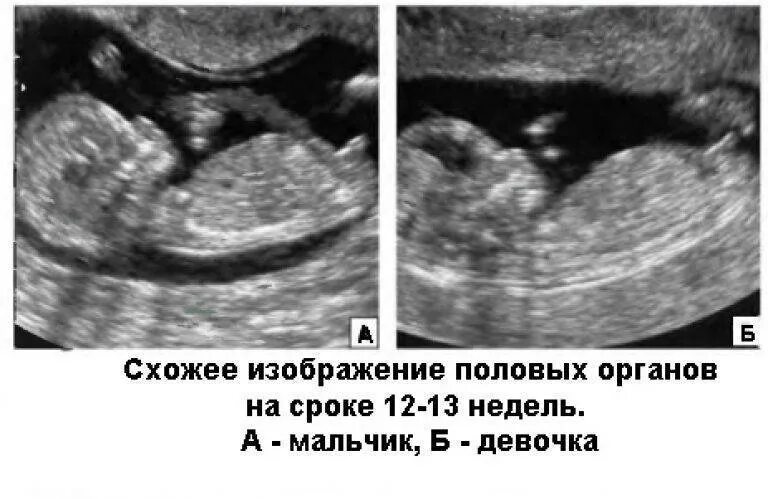 Пол по узи с какой недели