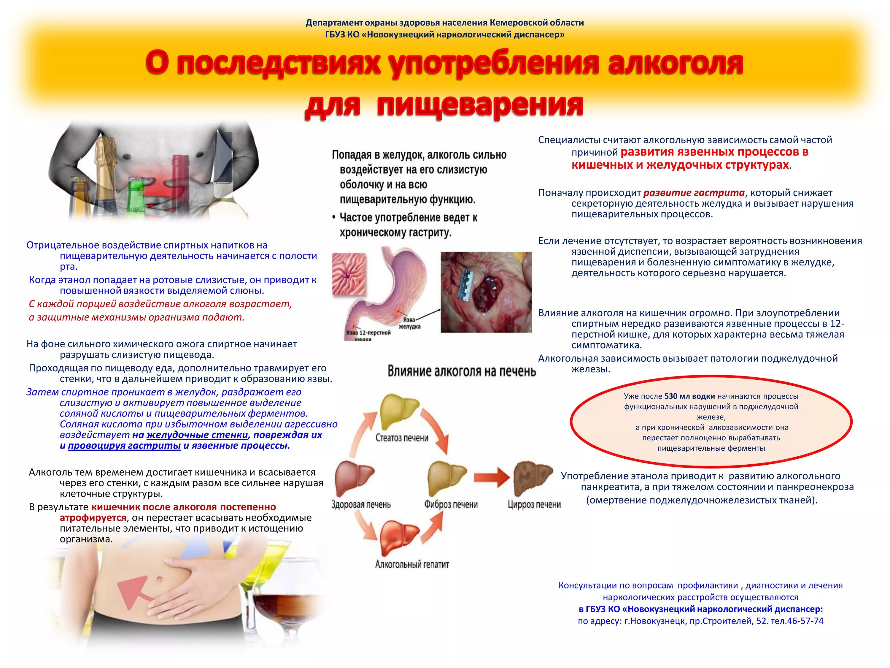 Профилактика цирроза печени. Профилактика болезней печени. Профилактика алкогольного цирроза печени.