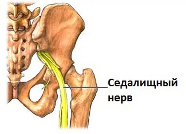 Блокада при защемлении седалищного. Анатомия тазобедренного сустава седалищного нерва. Повреждение нервных стволов. Защемление нервов. Снимок поврежденного седалищного нерва.