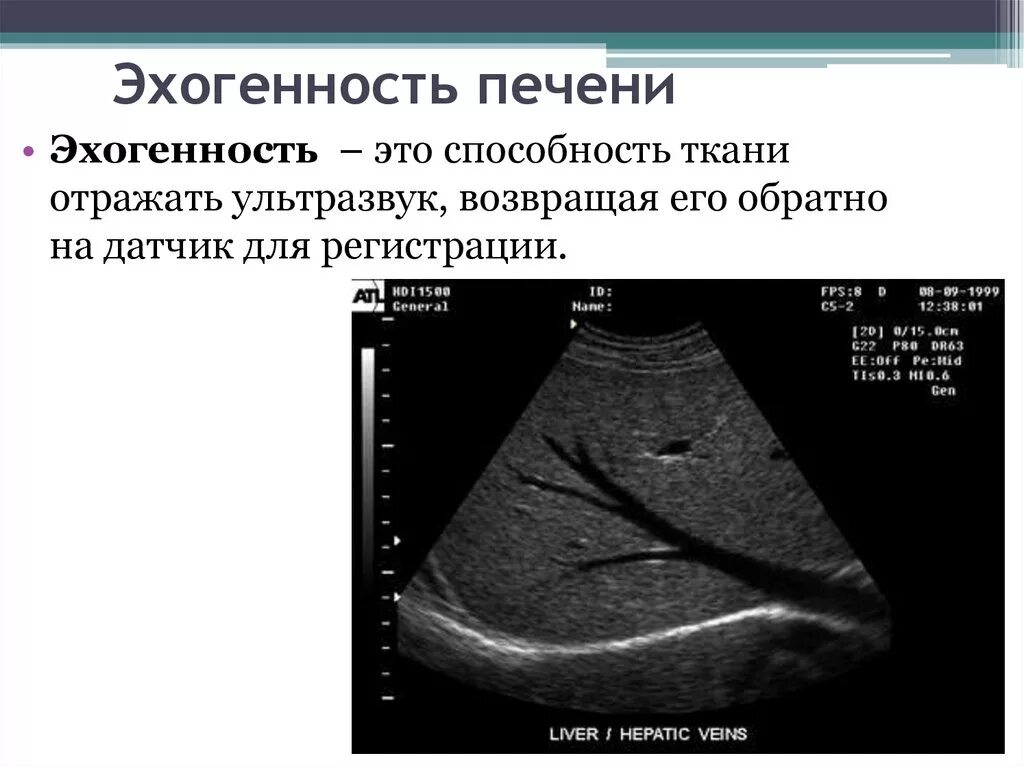 Печень эхогенность неоднородная. Эхогенность печени. Эхогенность печени повышена что это такое. Повышение эхогенности печени на УЗИ. Понижение эхогенности паренхимы печени.