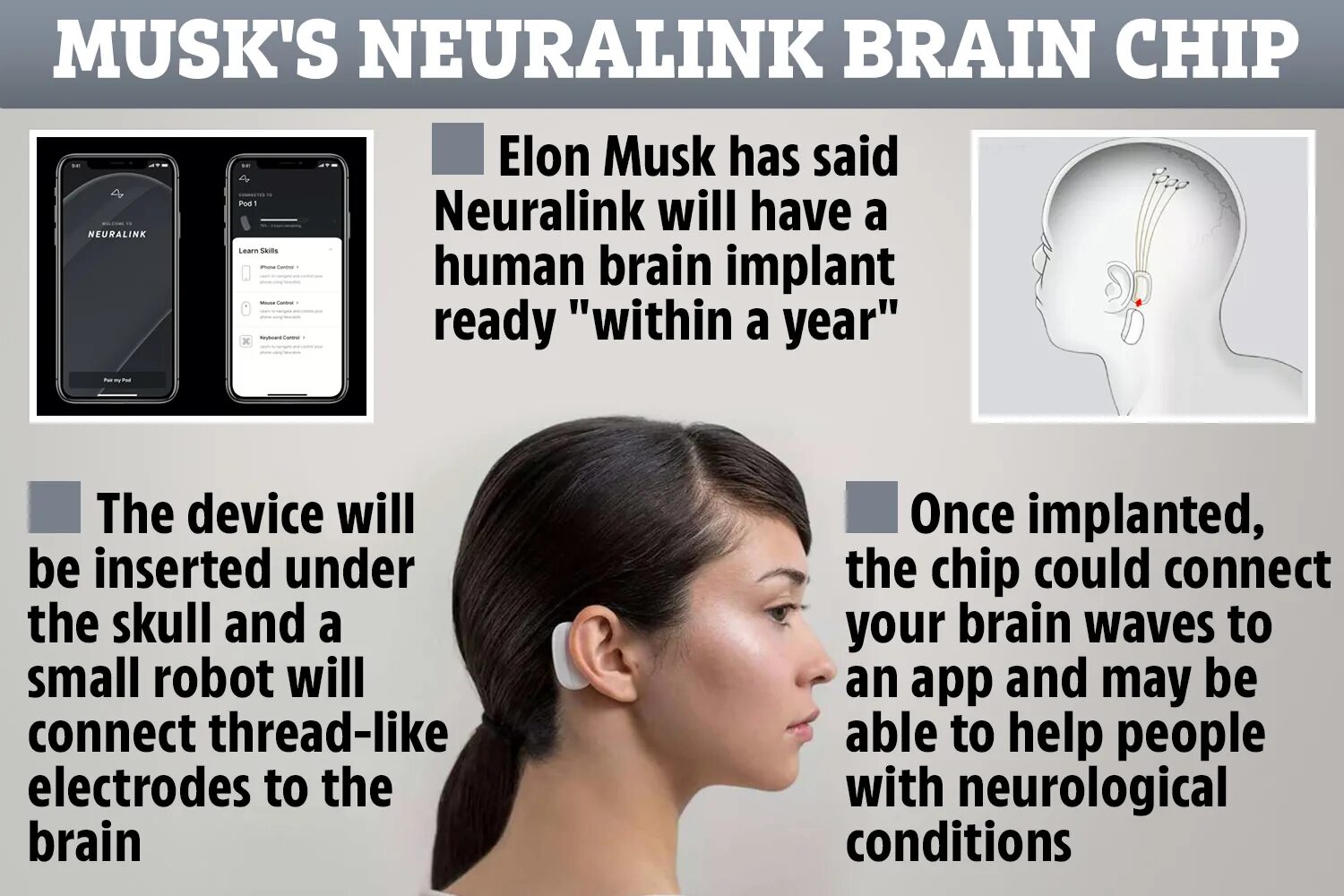 Neuralink Илон Маск. Neuralink чип. Чип Нейролинк Илон Маск. Илон Маск чип в мозг.