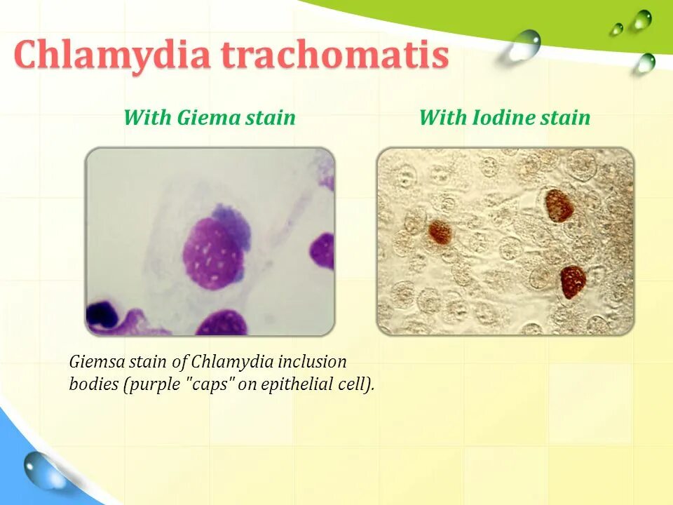 Chlamydia trachomatis. Хламидия трахоматис (Chlamydia trachomatis. Хламидия положительный. Chlamydia trachomatis представляет собой:.