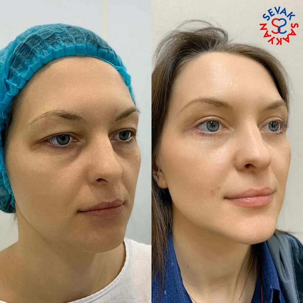 севак самвелович саакян пластический хирург, сургут. севак саакян сургут. саакян пластический хирург. севак саакян сургут самвелович пластический. севак еганян.