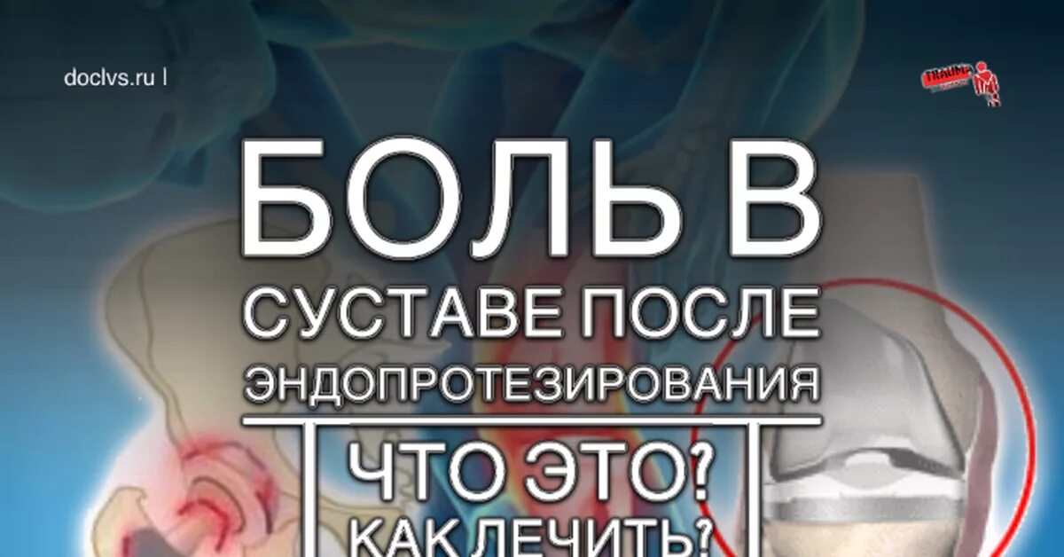 Боли после операции на тазобедренном. Протезирование коленного сустава. Боли в суставе после эндопротезирования тазобедренного сустава. Эндопротезирование коленного сустава. Эндопротезирования тазобедренного сустава боли в коленном.