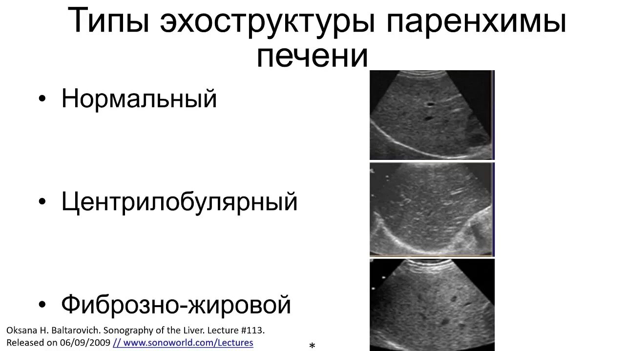 Диагноз диффузная печени. Диффузно очаговая паренхима печени. Очаговые поражения паренхимы печени.. Эхо структура парихемыпечени. Паренхима печени диффузно изменена.