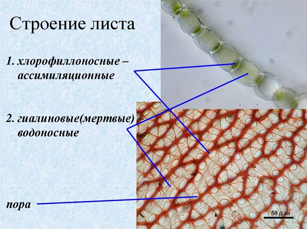Водоносные клетки в листьях имеет. Хлорофиллоносные клетки листа. Ассимиляционные клетки сфагнума. Хлорофиллоносные и водоносные клетки сфагнума. Строение листа.