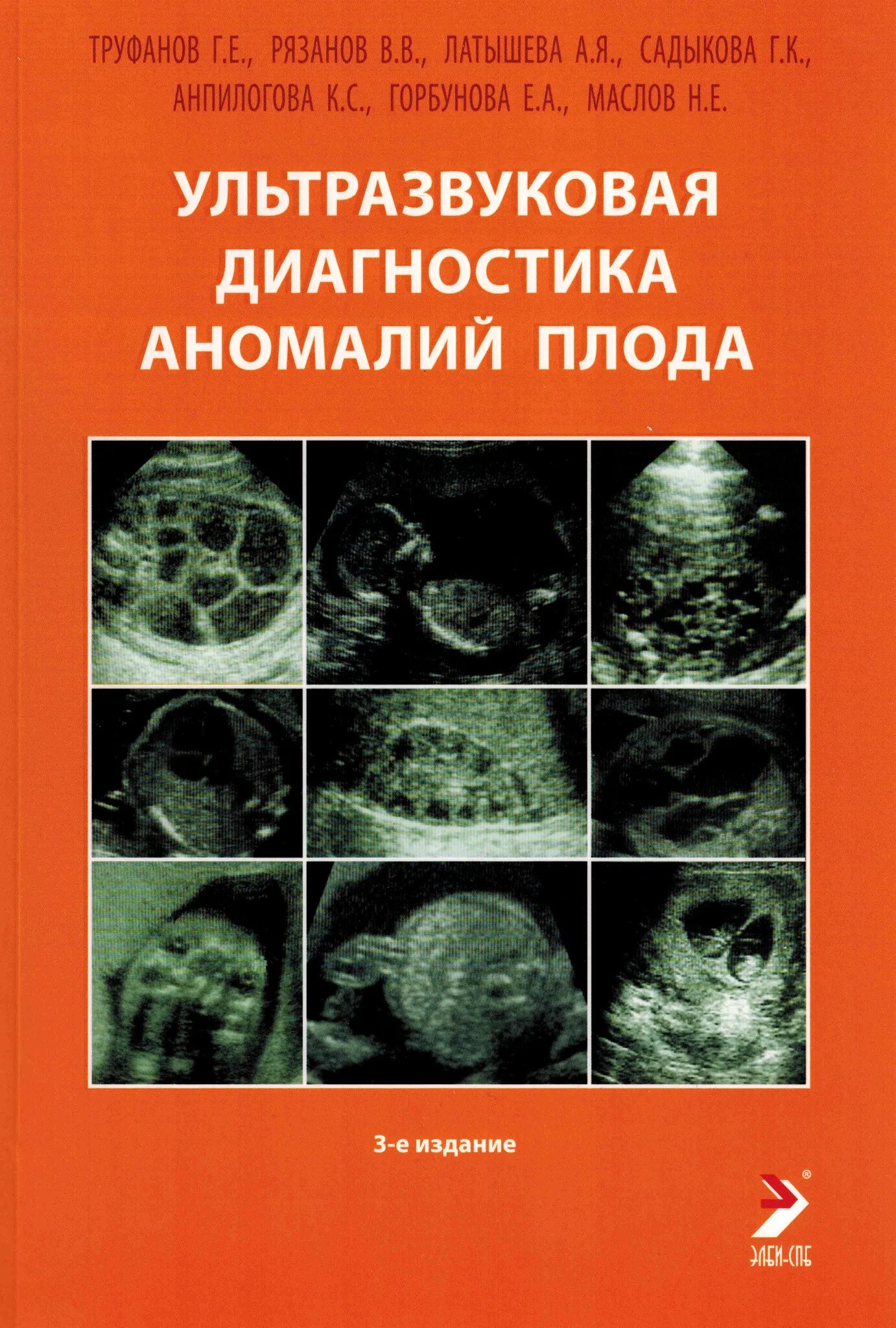 Узи аномалий. Ультразвуковая диагностика аномалий плода Рязанова Труфанов. Книги по УЗИ. Ультразвуковая диагностика книги. Книги УЗИ диагностика.