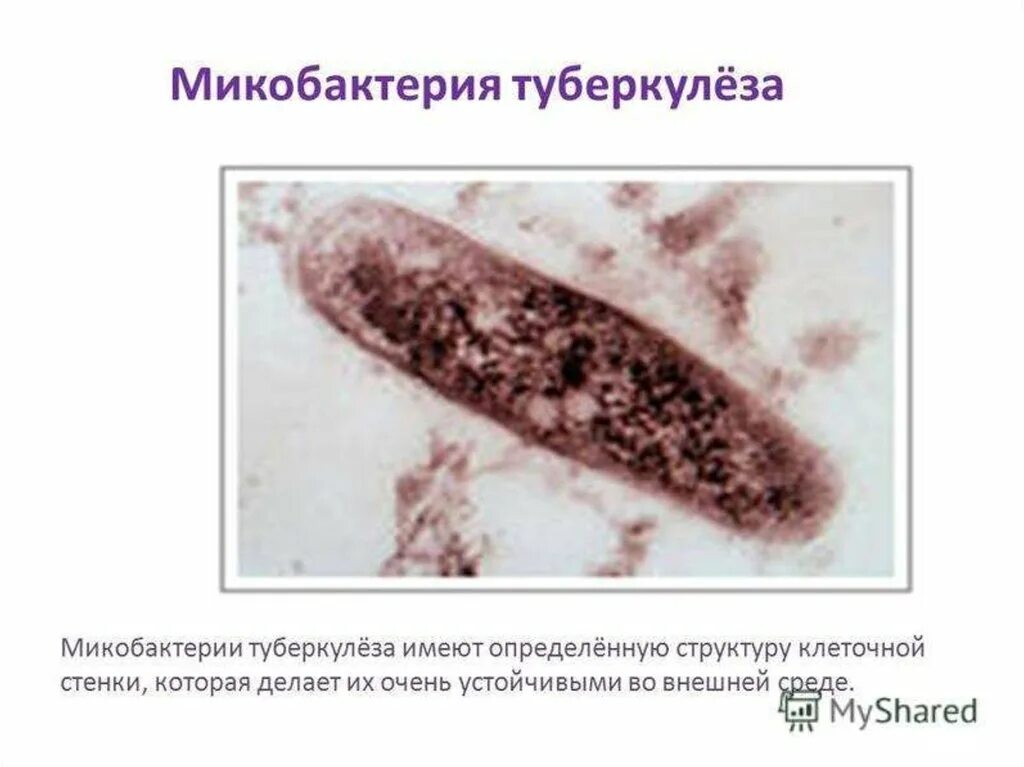 Заболевание туберкулез вызывают бактерии. Микобактерия палочки Коха. Палочки – микобактерия туберкулеза. Палочка Коха возбудитель туберкулеза. Палочка Коха Mycobacterium tuberculosis.